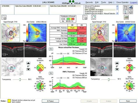 Carl Zeiss Cirrus Hd Oct 5000 Nava Ophthalmic