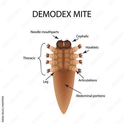 The Structure Of The Demodex Mite Demodecosis Infographics Vector Illustration On Isolated