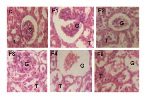 Effects Of Fenitrothion On Kidney Histopathology In Rats Using H E