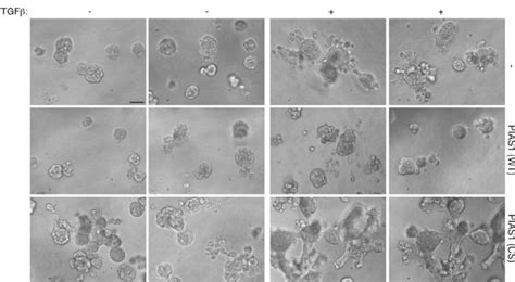 The Sumo E Ligase Pias Inhibits Tgf Induced Disorganization Of