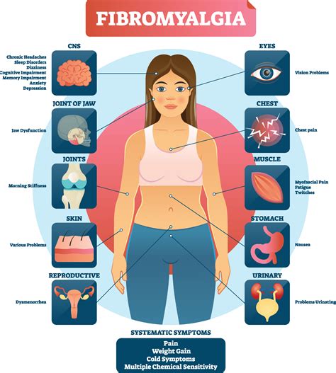 FIBROMYALGIA SYMPTOMS – Adam Sewell MD Blog