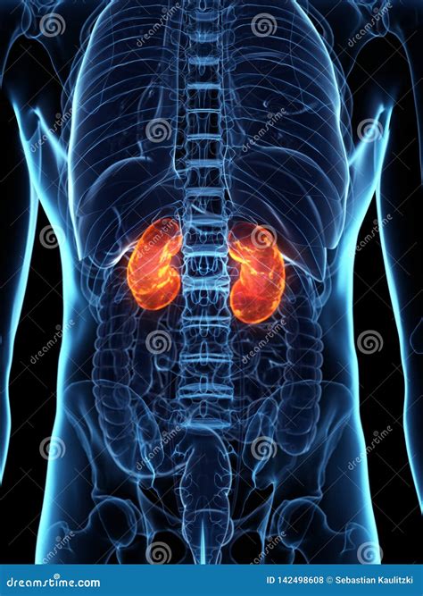 A diseased kidney stock illustration. Illustration of health - 142498608