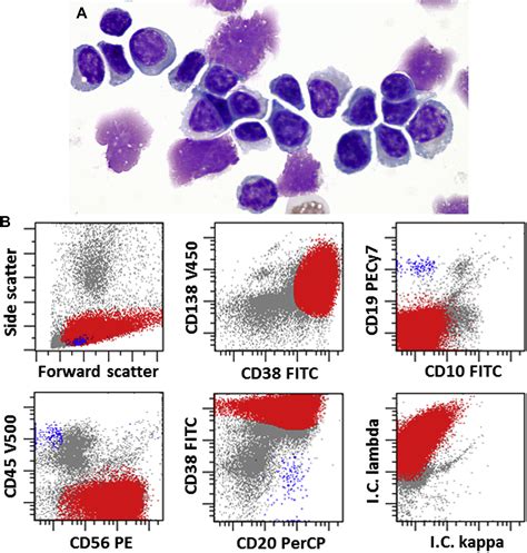 Role Of Flow Cytometry In The Diagnosis And Prognosis Of Plasma Cell