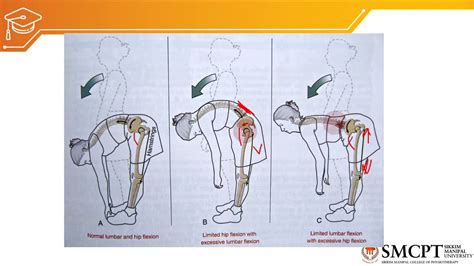 Biomechanics Of Lumbar Spine YouTube