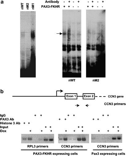 EMSA Detection Of Direct Binding Of Purified GST PAX3 FKHR Fusion