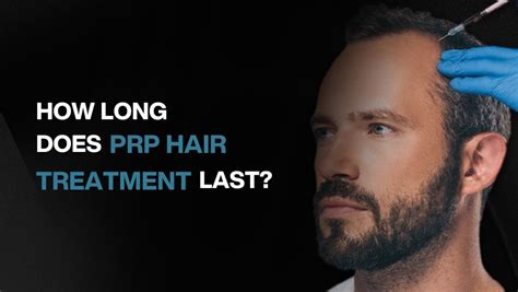 How Long Does PRP Hair Treatment Last BlueMagic Group