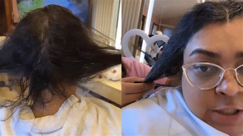 Preta Gil Relata Perda De Do Cabelo Durante Tratamento Contra O