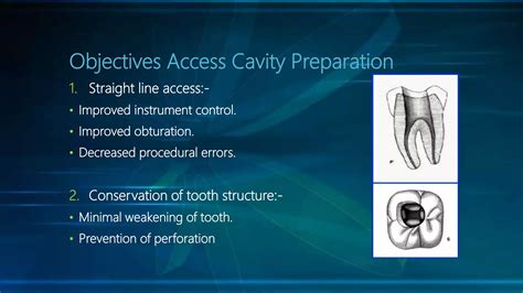 Endodontic Access Cavity Preparation PPT