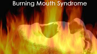 Educational Dentistry by - Dr. David Dersh!: Burning Mouth Syndrome