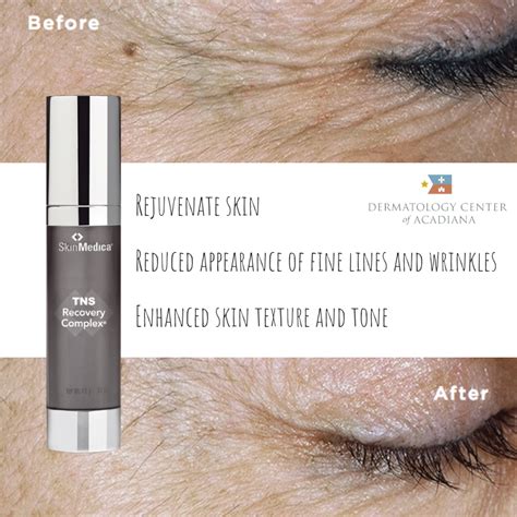 Tns Recovery Complex Reduce Fine Lines And Wrinkles