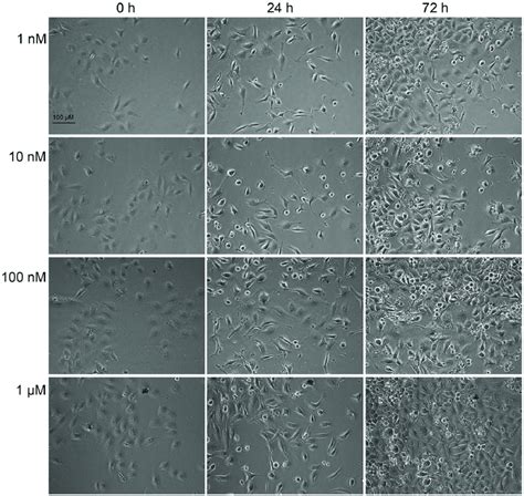 Effect Of Pma On Hela Cell Proliferation And Morphology Hela Cells