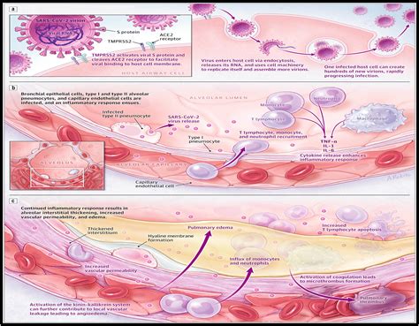 COVID 19 And SARS CoV 2 Everything We Know So Far A Comprehensive Review