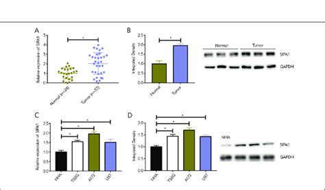 Upregulation Of Sipa1 In Glioma A The Mrna Level Of Sipa1 In Glioma