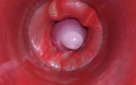 Camera Inside Pussy Powerfull Cum In Pussy Best Internal Asmr In K More Sperm Gay Porn XHamster