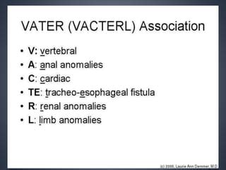 vacterl association embryology  recognition pptx