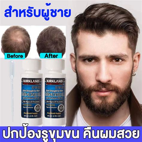 เซรั่มปลูกผม Hair Tonic Serum Liquid Growth Of Beard เซรัม ผมร่วง