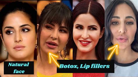 People Call Katrina Kaif Puffer Fish After Her Cosmetic Surgery On