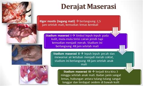 Kematian Janin Dalam Rahim Oshigitas Pageoshigitas Page