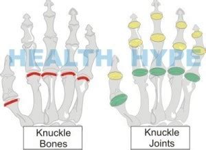 Knuckle Pain on Hand (Painful Finger Joints) Causes and Treatment ...