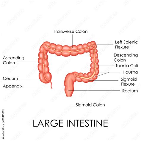 Conversion Of Taeniae Coli