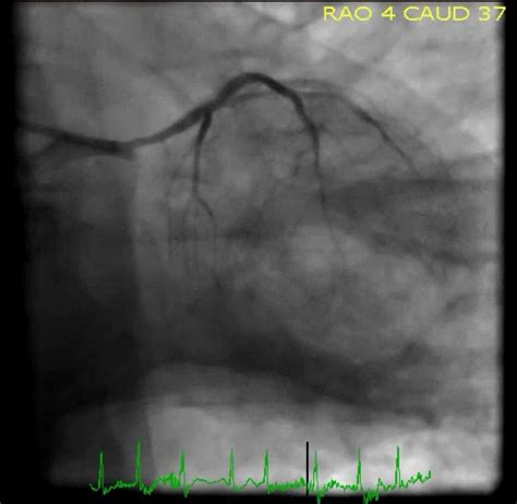 Dr. Smith's ECG Blog: May 2018