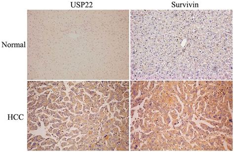 Immunohistochemical Staining For Usp And Survivin In Normal Adjacent