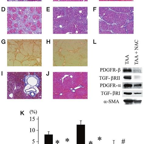 Regulation Of Pdgfr Expression In Primary Cultured Hsc By Nac A