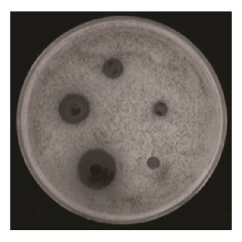 Agar Disk Diffusion Assay To Visualize The Synergism Of Fcz With Frc