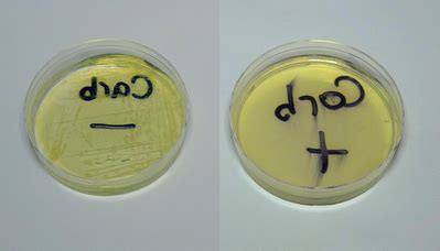 Addgene: Pouring LB Agar Plates