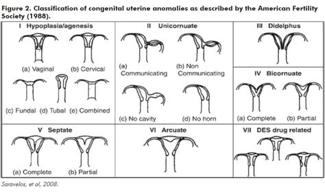 Uterine And Related Structural Anomalies Oandg Magazine