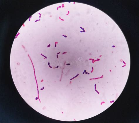 Staphylococcus Aureus Gram Stain