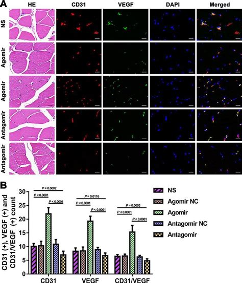 Expression Of Cd31 And Vegf In Tm Tissues From Each Group A He And Download Scientific