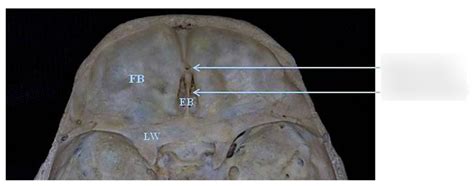 Anterior Cranial Fossa Diagram Quizlet