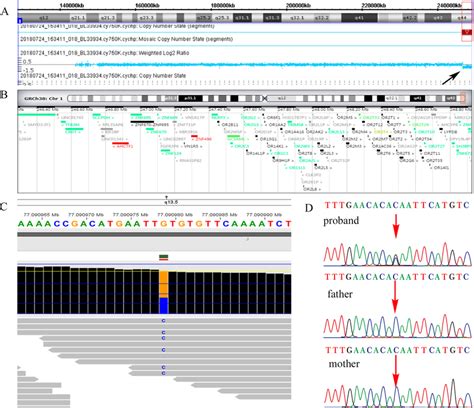 The result of chromosomal microarray analysis and whole exome ...