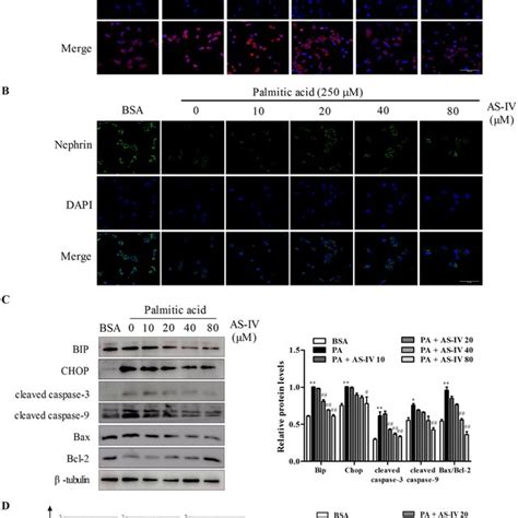 Effect Of As Iv On Palmitic Acid Pa Induced Er Stress And Podocyte