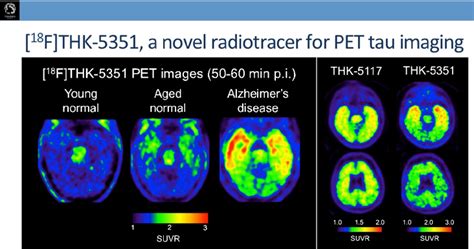 F Thk A Novel Radiotracer For Pet Tau Imaging With Improved