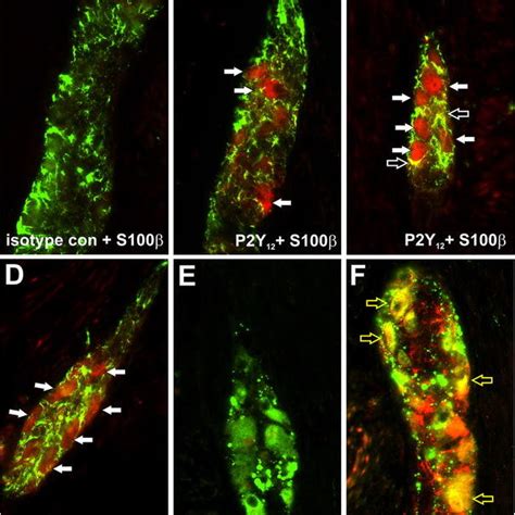 Sex Dependent Differences Of P Y Receptor Expression In Myenteric