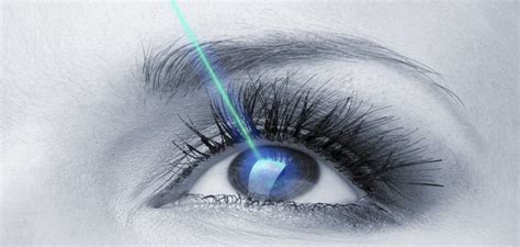 Benef Cios Da Cirurgia Ocular A Laser