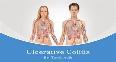 Download Free Medical Ulcerative Colitis Powerpoint Presentation