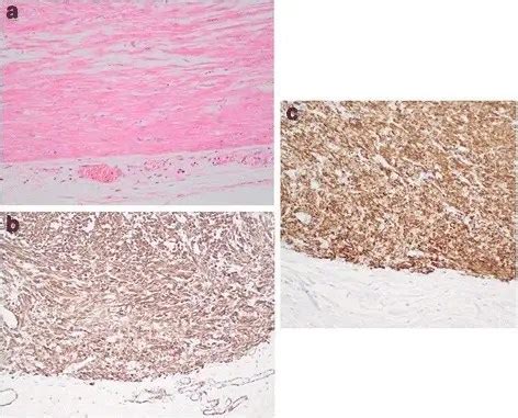 What Are Genetic Disorders Involving Sex Chromosomes Pathosomes