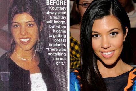 Kourtney Kardashian Plastic Surgery Before And After Photos