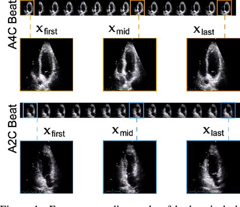 Figure 1 From Saf Net Self Attention Fusion Network For Myocardial