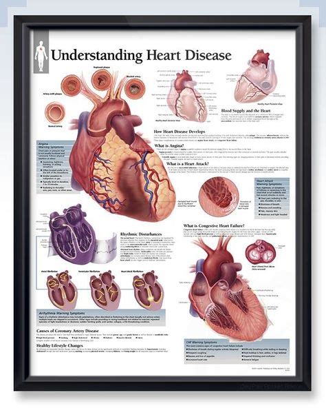 Understanding Heart Disease Chart 22x28 Heart Disease Ischemic Heart