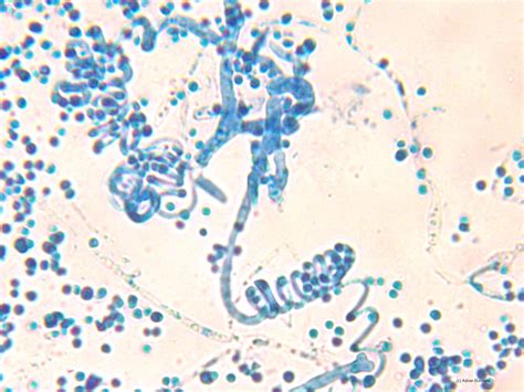 Trichophyton Verrucosum