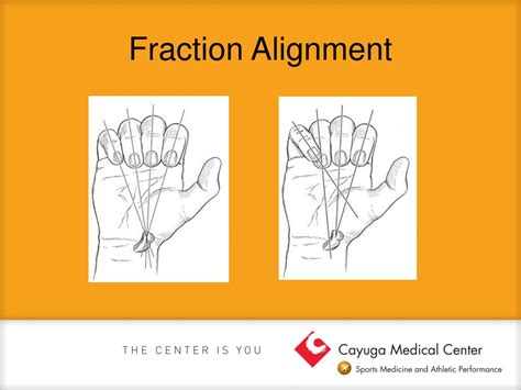 Ppt Common Hand And Wrist Injuries Powerpoint Presentation Free