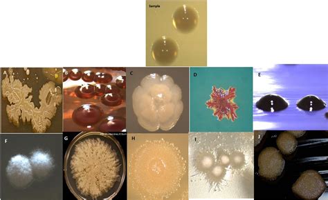 Solved Describe the morphology of the colonies on the plates | Chegg.com