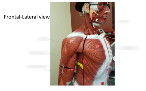 Frontal Lateral View Diagram Quizlet