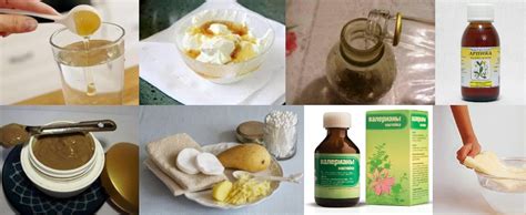 Характерные признаки ушиба копчика и его лечение