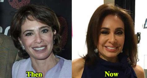 Jeanine Pirro Plastic Surgery: Botox, Facelift, Cheek Fillers, Lip Fillers