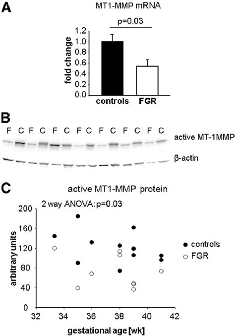 Expression Of Mt1 Mmp Mrna And Enzyme In Fgr Placentas And Age Matched